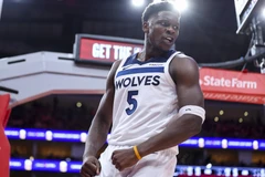 安东尼·爱德华兹